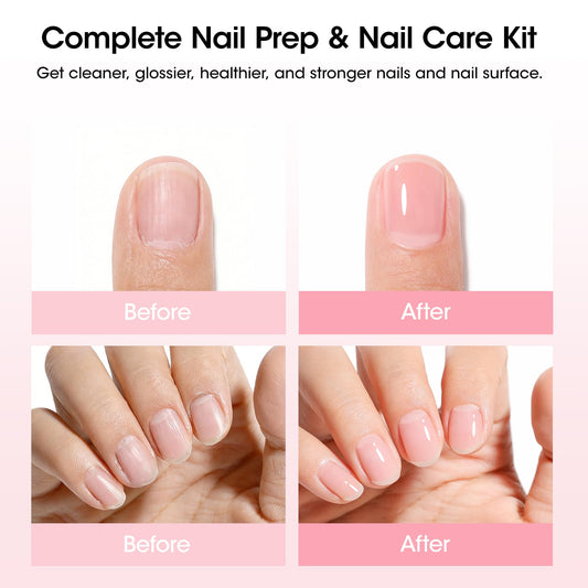 GELLEN strengthener bottle close-up highlighting formula label and quick-dry benefit for easy use