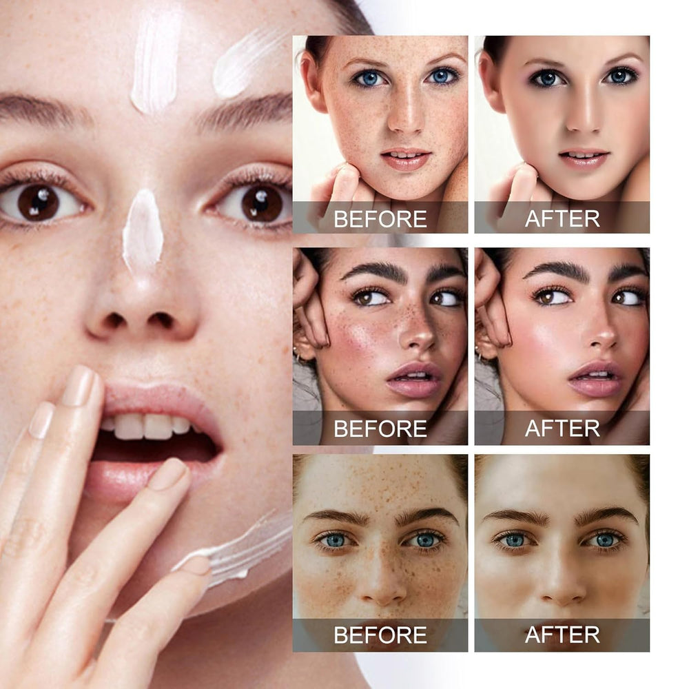 Generic hand applying cream to face demonstrating targeted spot treatment benefit