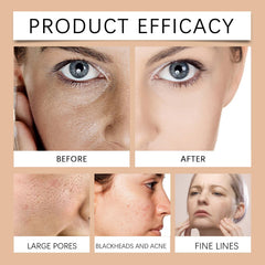 Generic peel-off action being removed to reveal refreshed, smoother-looking skin