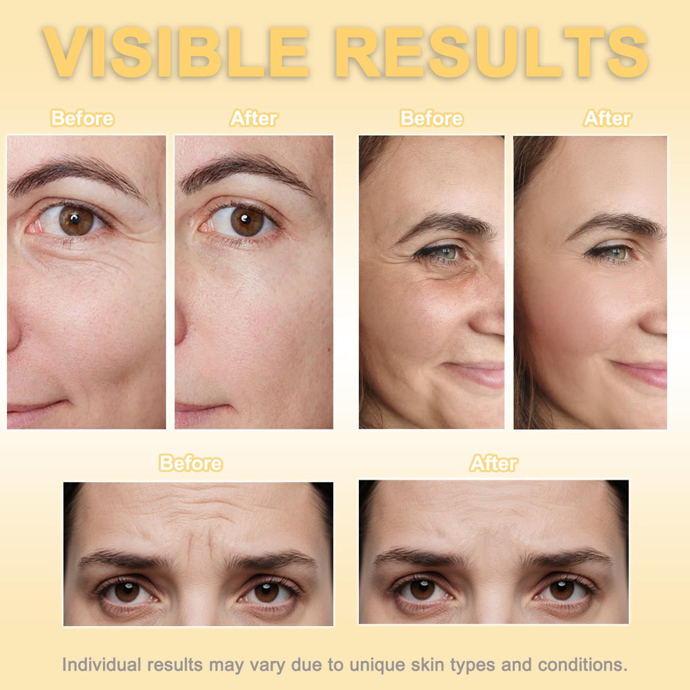 Generic face tape on eye area illustrating crow's feet reduction and gentle hold