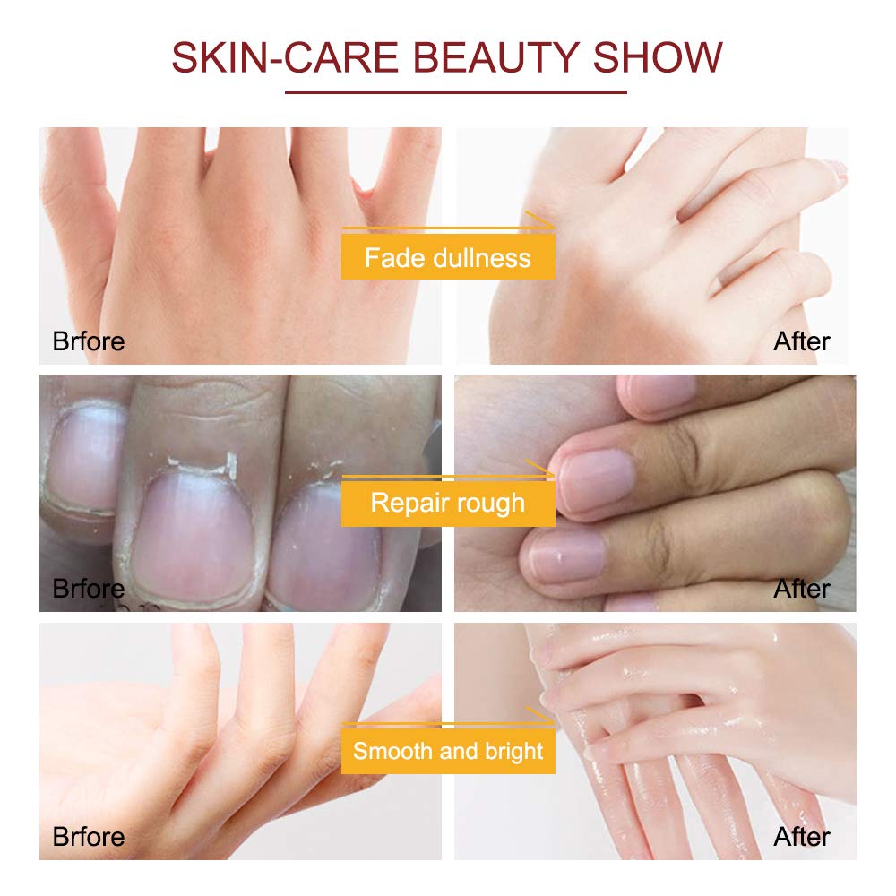 Generic hands after peel showing removed dead skin and smoother texture benefit
