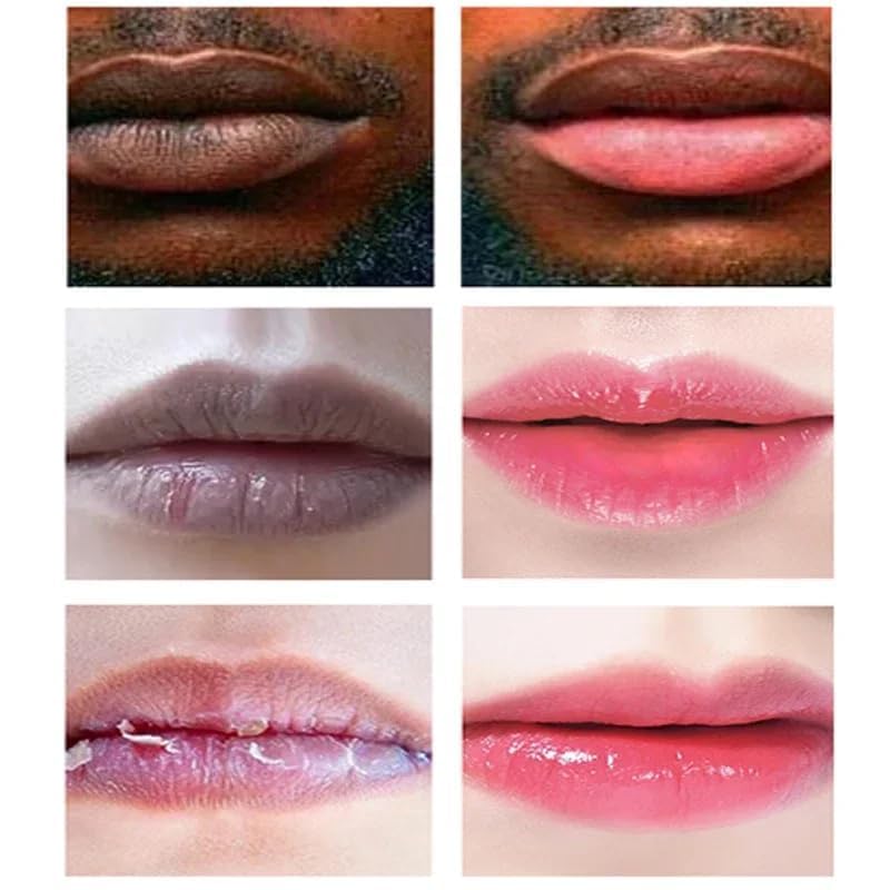 Generic lip balm before and after comparison showing tone improvement