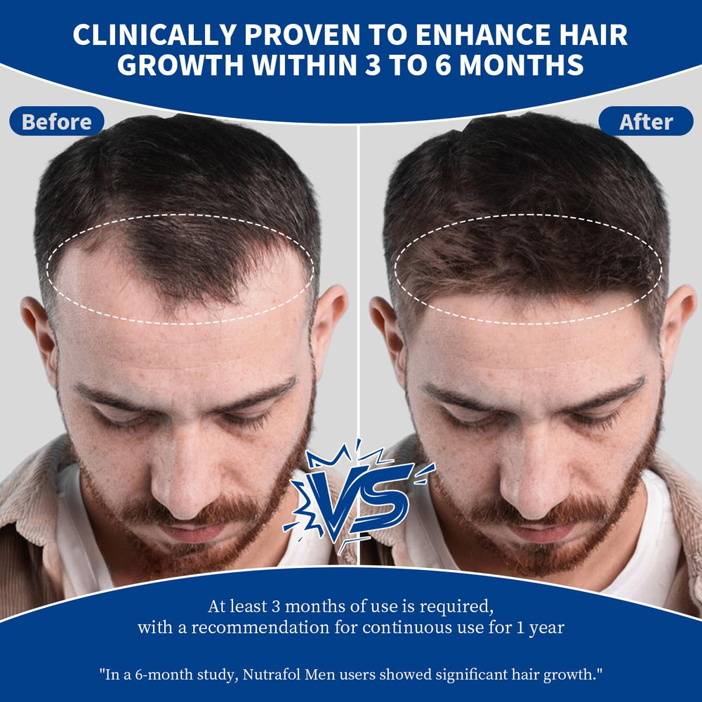 Generic beard application demo showing targeted use for fuller-looking facial hair