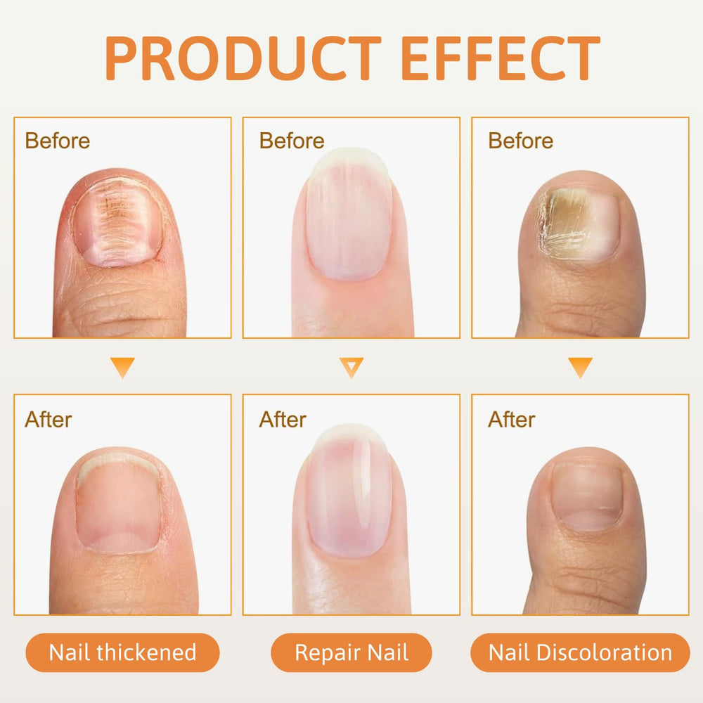 Generic nail texture close-up showing smoother, shinier nails after use