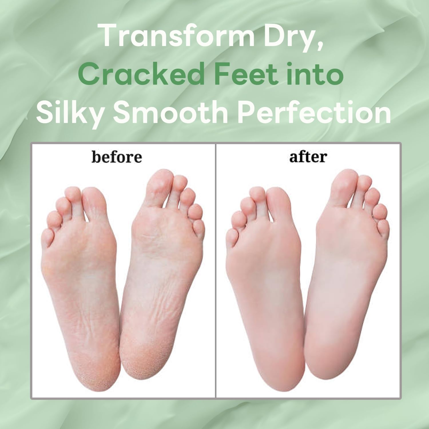 Generic night routine socks image showing overnight application for intensive skin softening