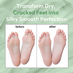 Generic night routine socks image showing overnight application for intensive skin softening