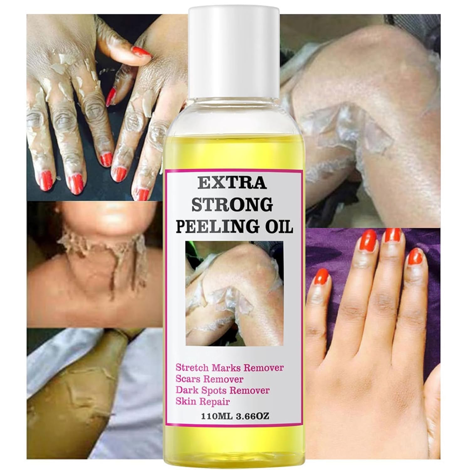 Generic applying peeling oil to hand demonstrating easy at-home use benefit