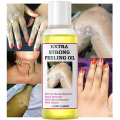 Generic applying peeling oil to hand demonstrating easy at-home use benefit