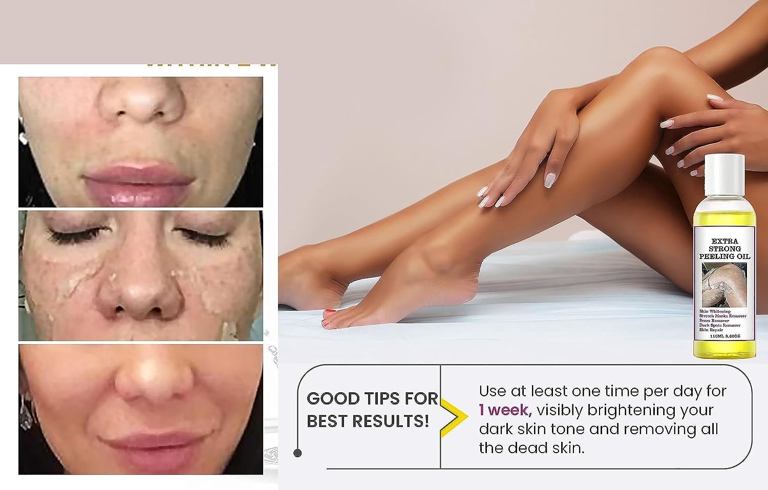 Generic peeling oil applied to elbow showing smoothing benefit on rough skin