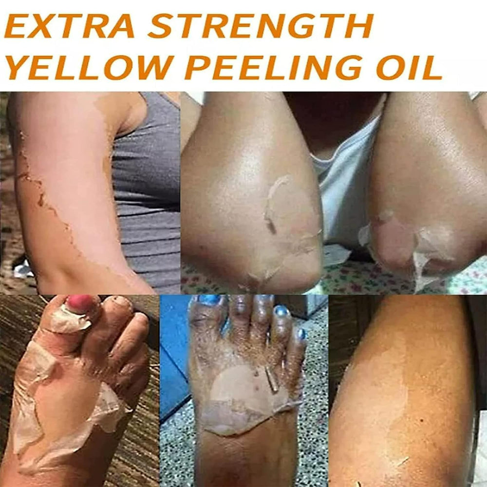 Generic peeling oil next to ruler showing 110ml size and travel-friendly benefit