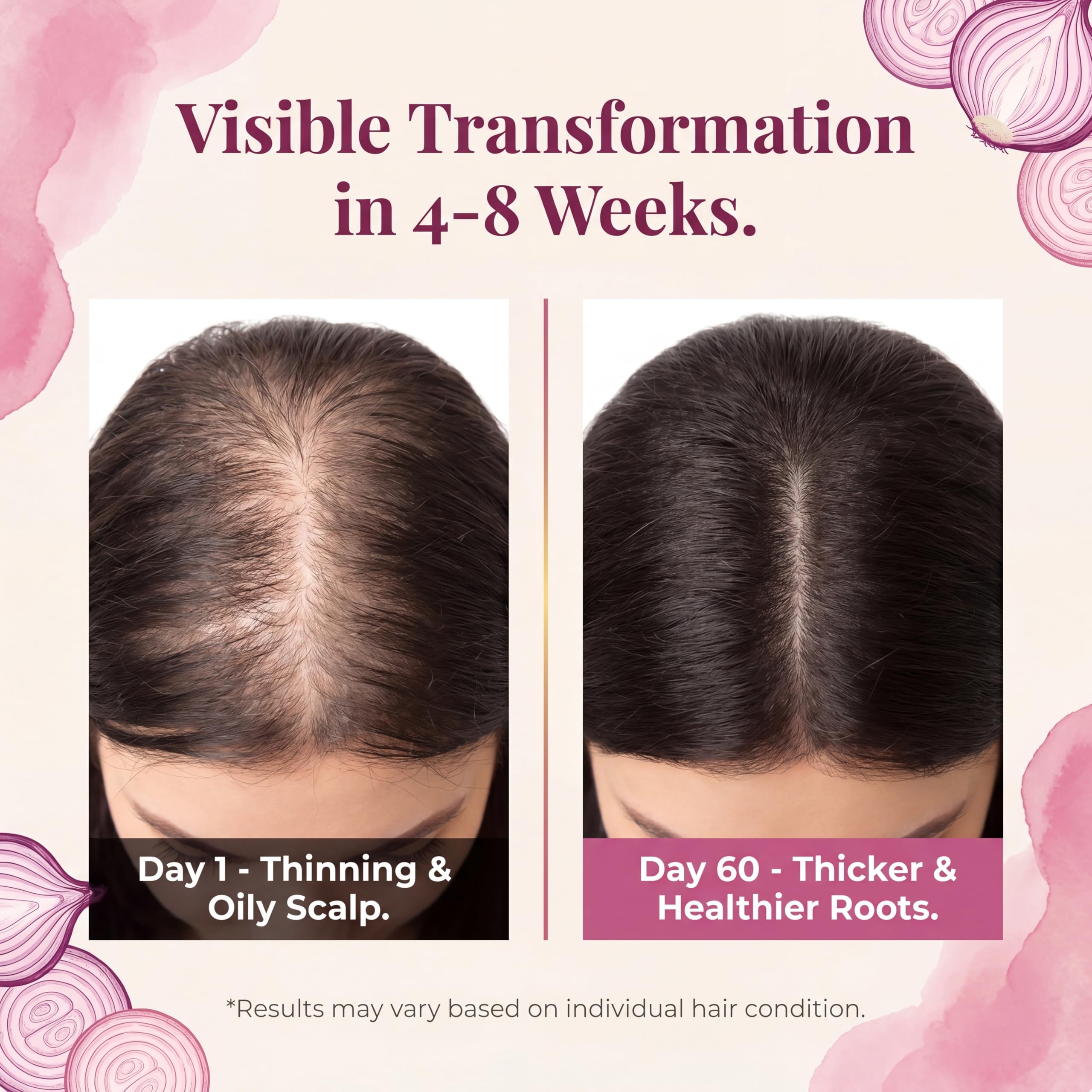 Generic demonstrating bar rubbed along scalp illustrating easy application