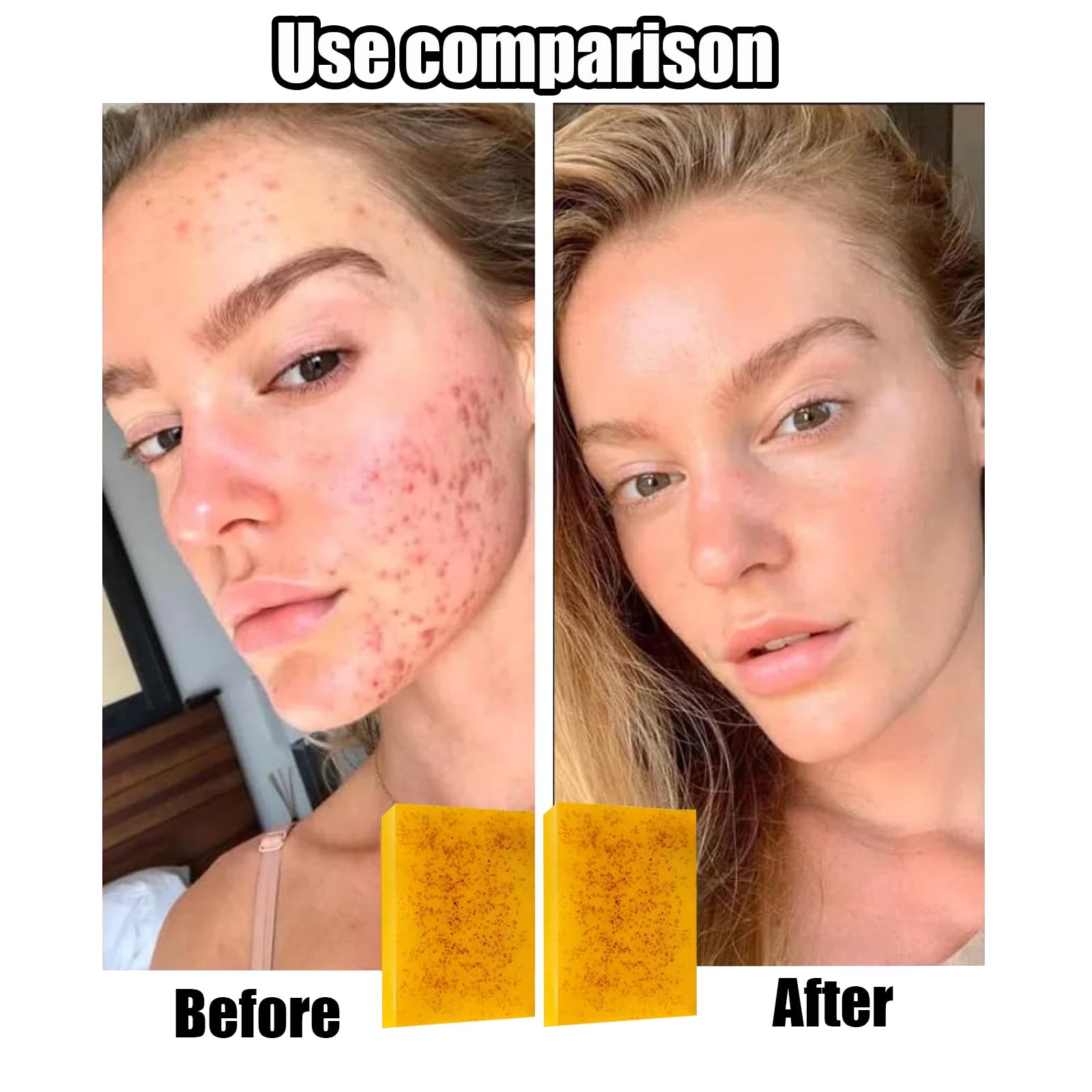 Generic close-up of textured exfoliating side for gentle skin smoothing