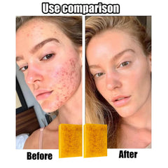 Generic close-up of textured exfoliating side for gentle skin smoothing