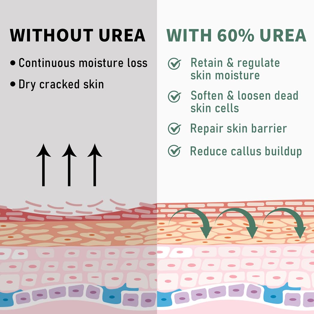 Generic brand urea cream ingredients label highlighting urea and salicylic acid benefits