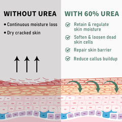 Generic brand urea cream ingredients label highlighting urea and salicylic acid benefits