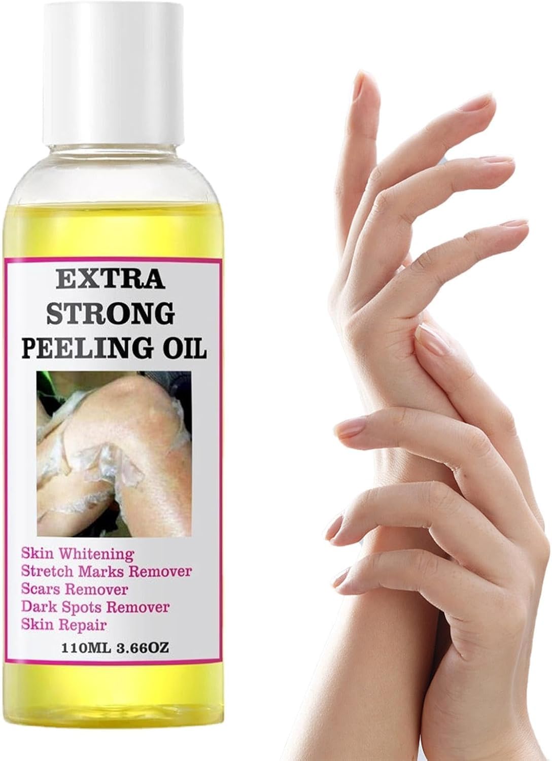 Generic yellow peeling oil front bottle showing packaging and calming benefit