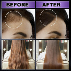 GIFBEA application spraying scalp to nourish roots and refresh hair