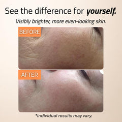 GLEOW applying serum to face and neck for visible smoothing benefit