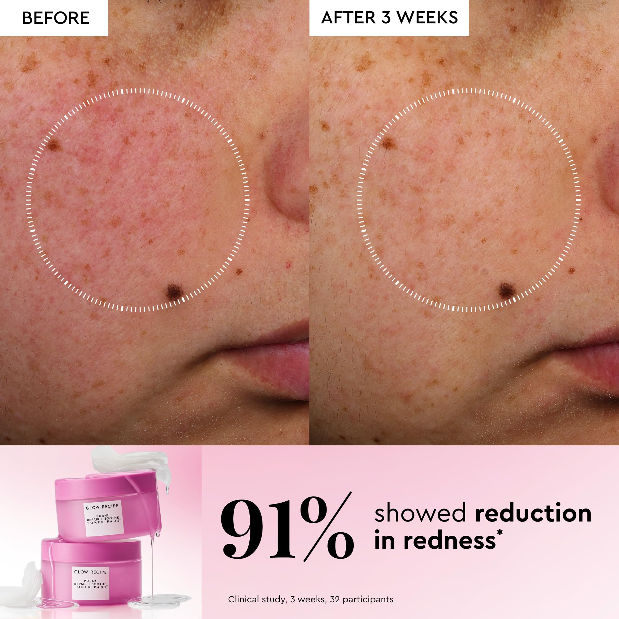 Glow Recipe pad pressed to cheek as five-minute mini mask comfort