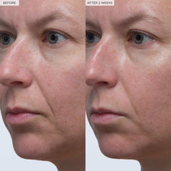 Glow Recipe before and after glow comparison illustrating improved radiance and plumping effect