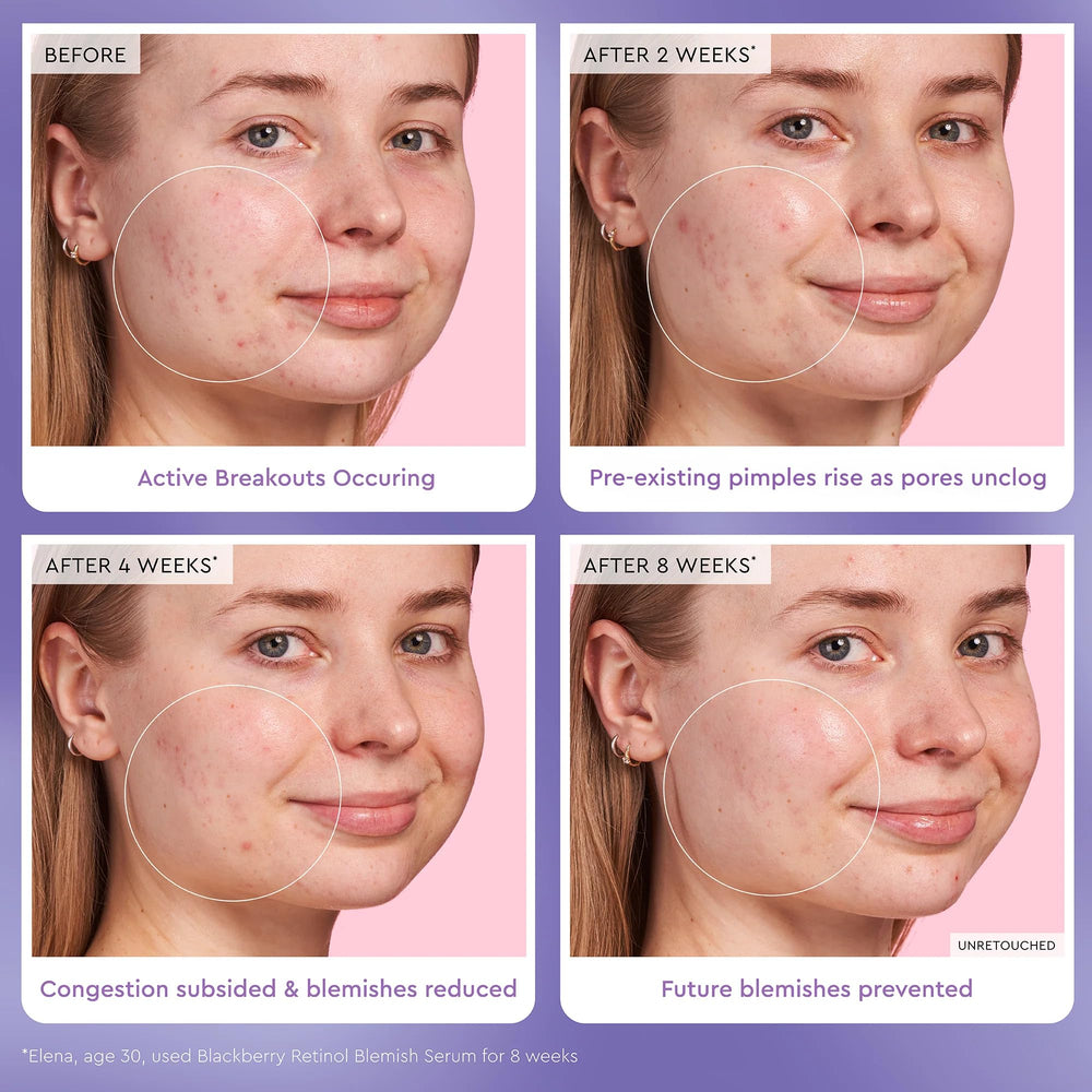 Glow Recipe applying serum to cheek illustrating gentle absorption