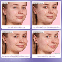 Glow Recipe applying serum to cheek illustrating gentle absorption