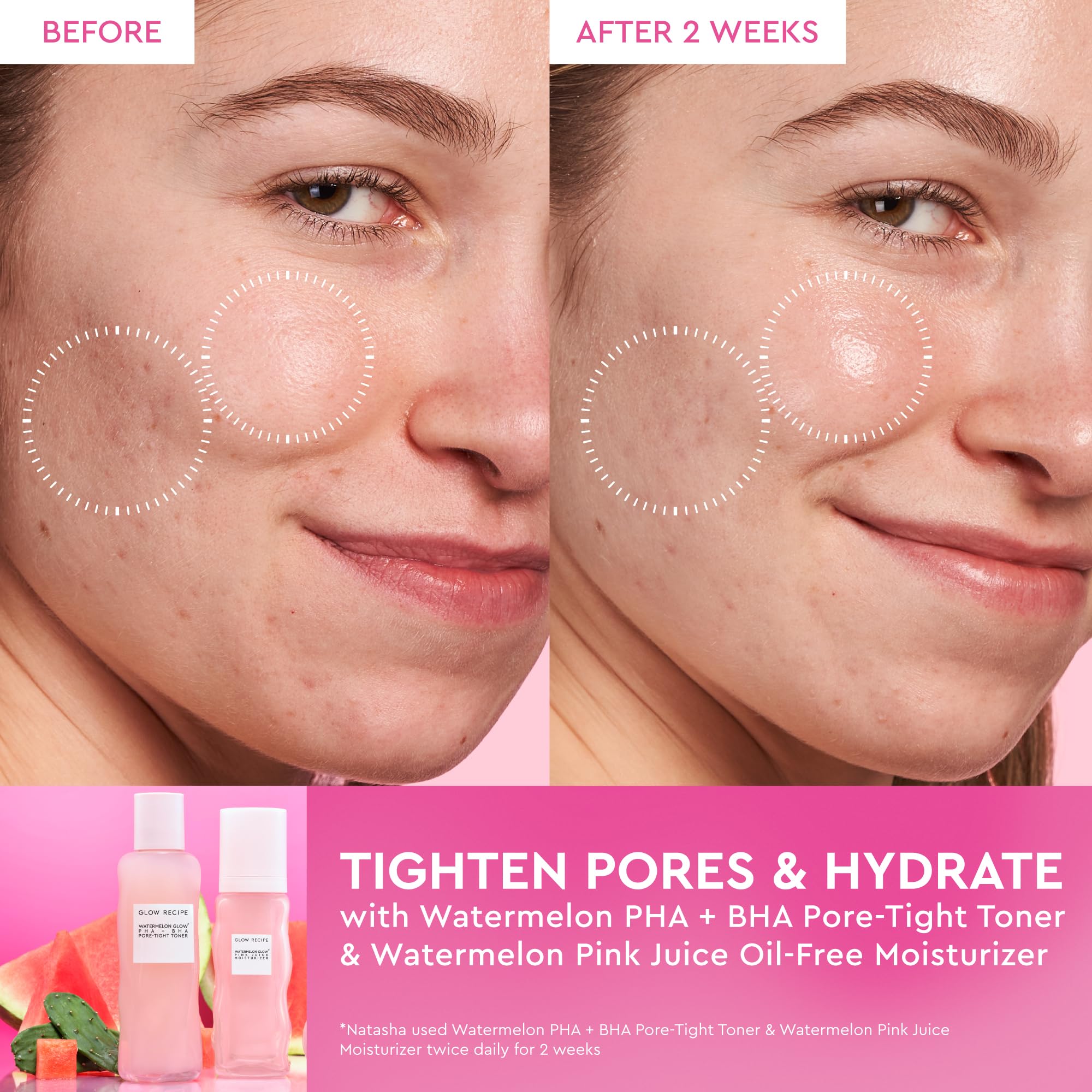 Glow Recipe watermelon extract close-up illustrating antioxidant hydration