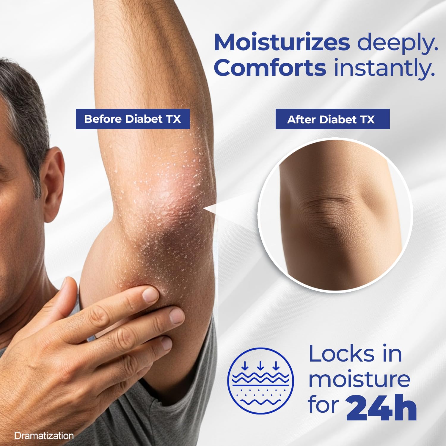 Goicoechea applied to hands and elbow to soothe dry skin
