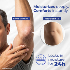 Goicoechea applied to hands and elbow to soothe dry skin
