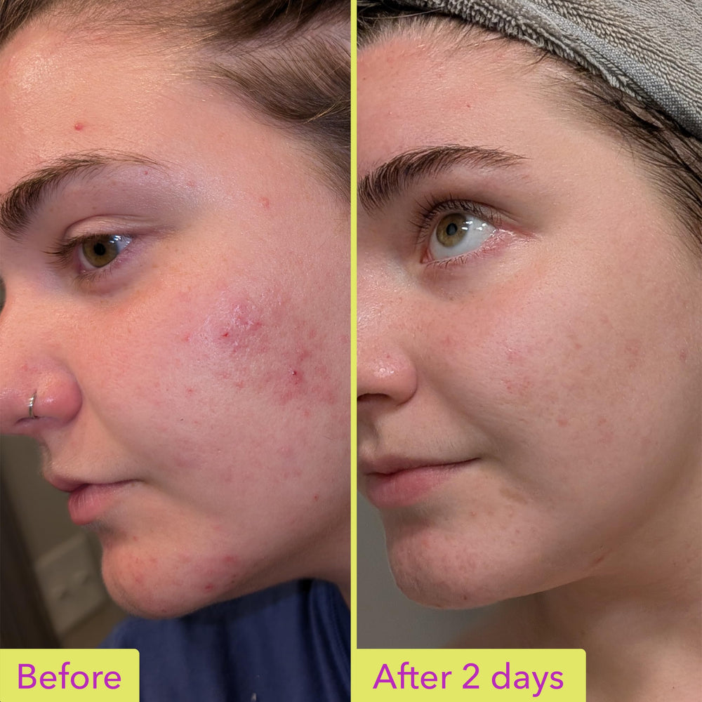 Good Molecules gel-serum texture close-up showing smooth absorption
