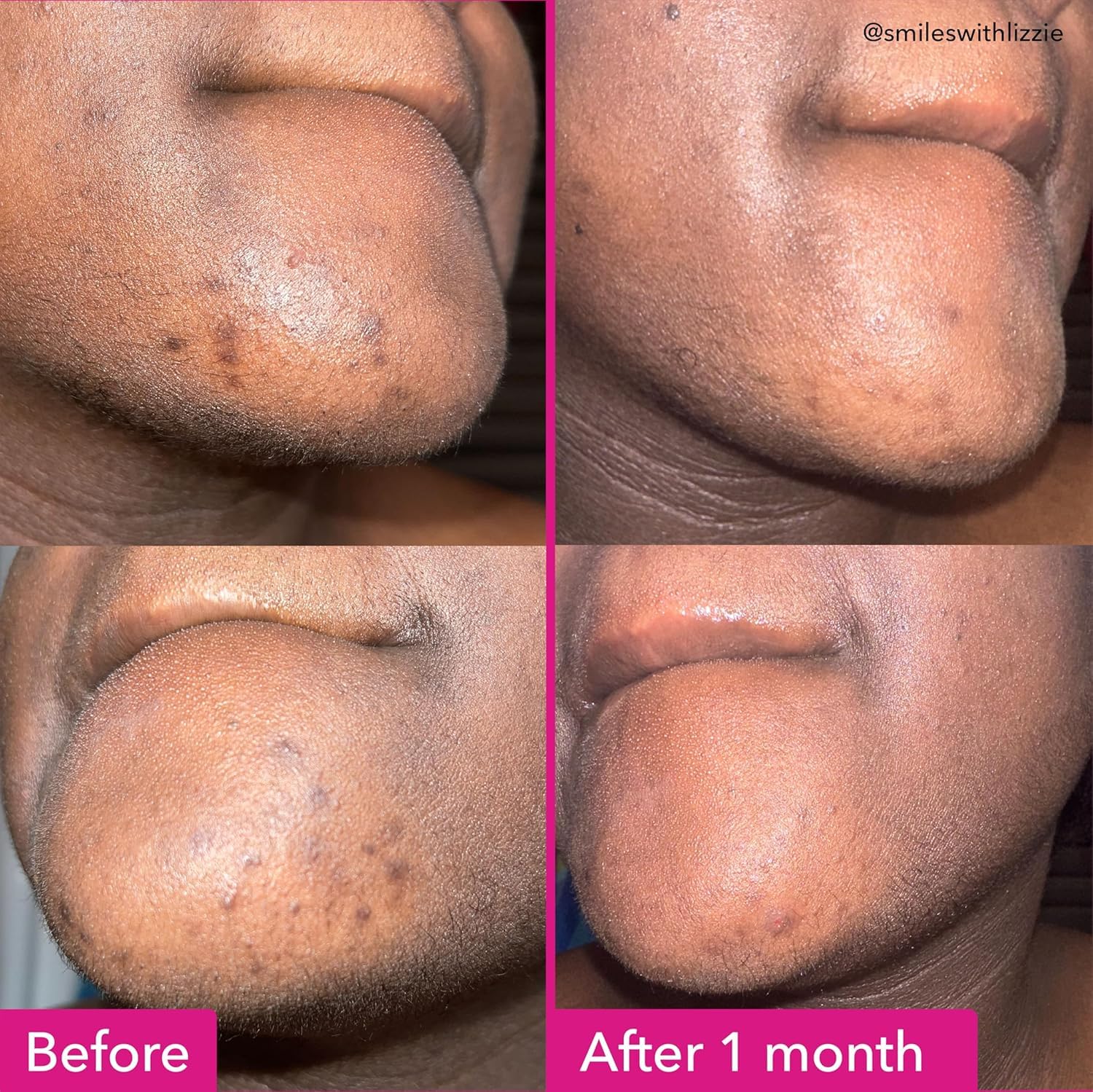 Good Molecules bar texture close-up highlighting smooth, nourishing formula