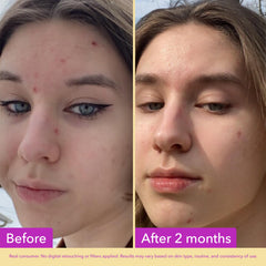 Good Molecules clear serum texture on skin demonstrating fast absorption benefit