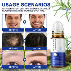 GPUPFJPW roll-on applied to scalp parting showing targeted delivery to follicles
