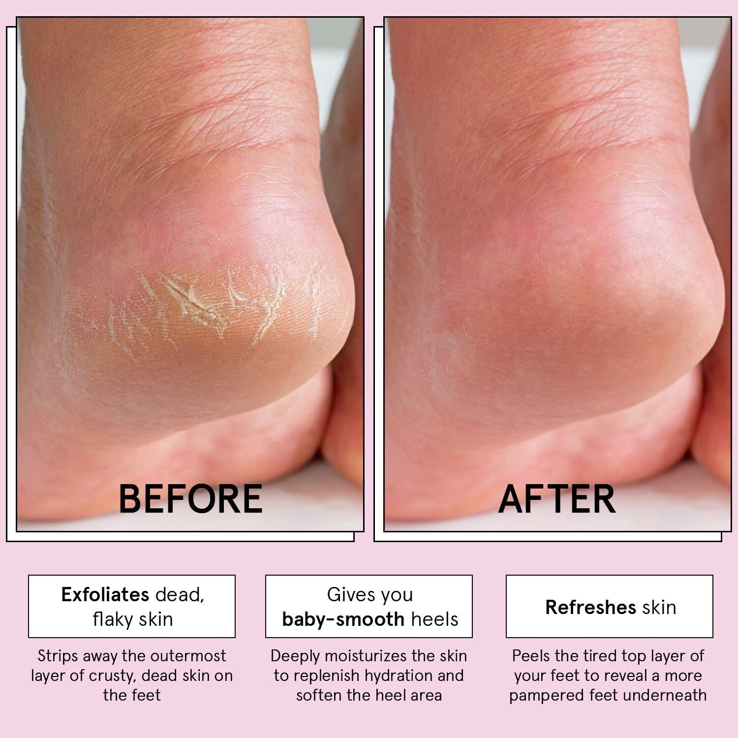 grace & stella booties in use on feet demonstrating easy at-home application comfort