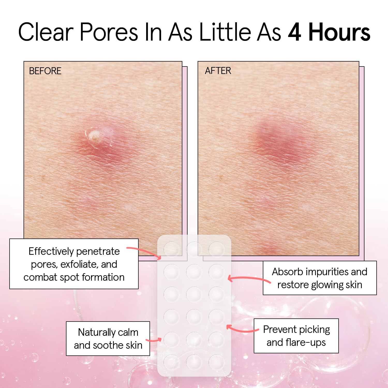 grace & stella patch applied on cheek for discreet coverage benefit