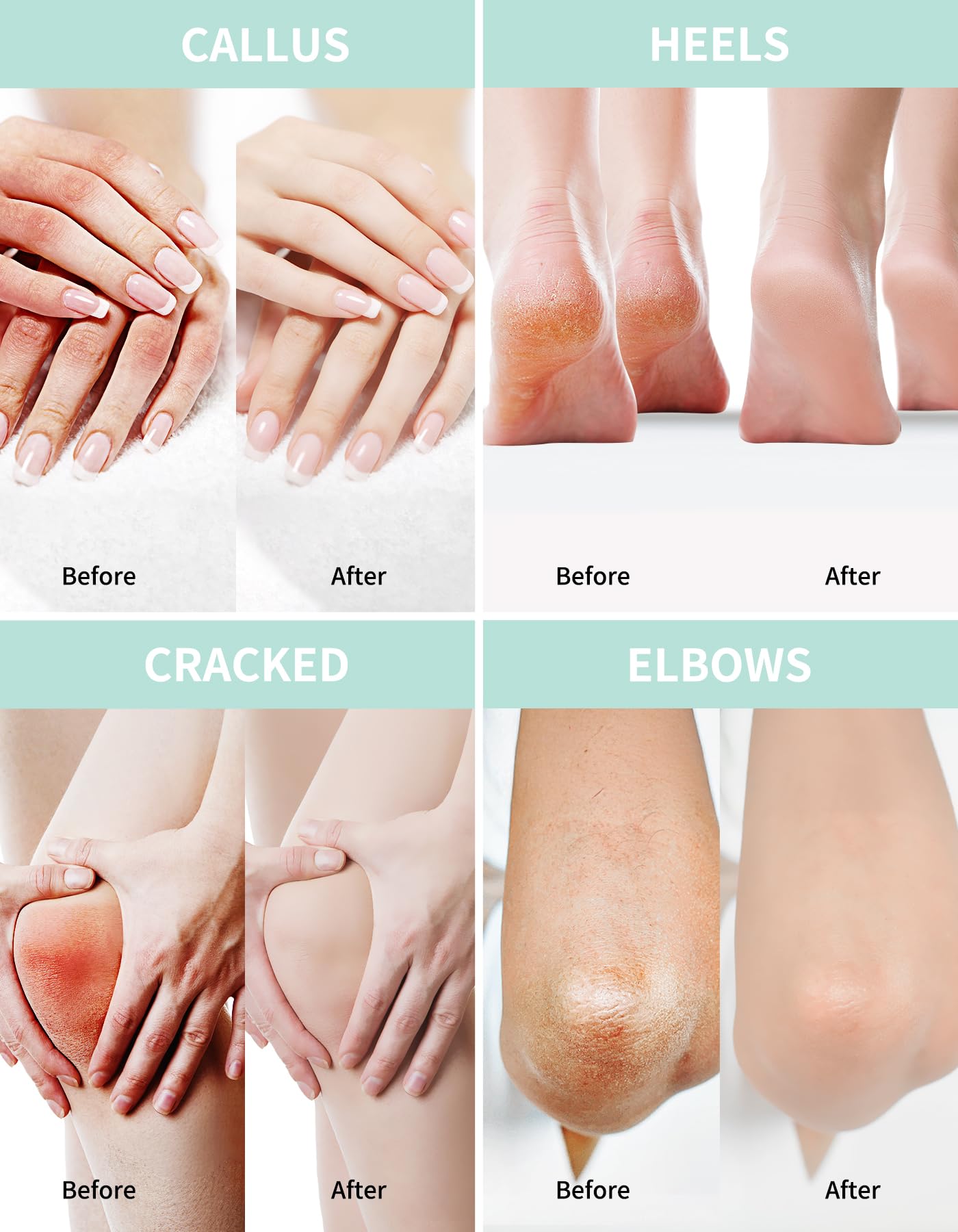 Grocerism ingredient detail image focusing on ceramide and botanical extracts for barrier support