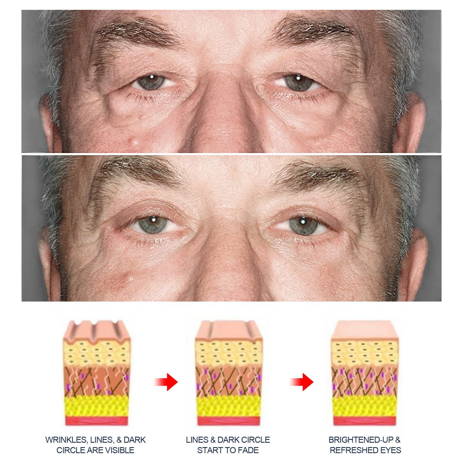 Grospe eye gel applied with ring finger demonstrating gentle patting