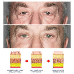 Grospe eye gel applied with ring finger demonstrating gentle patting