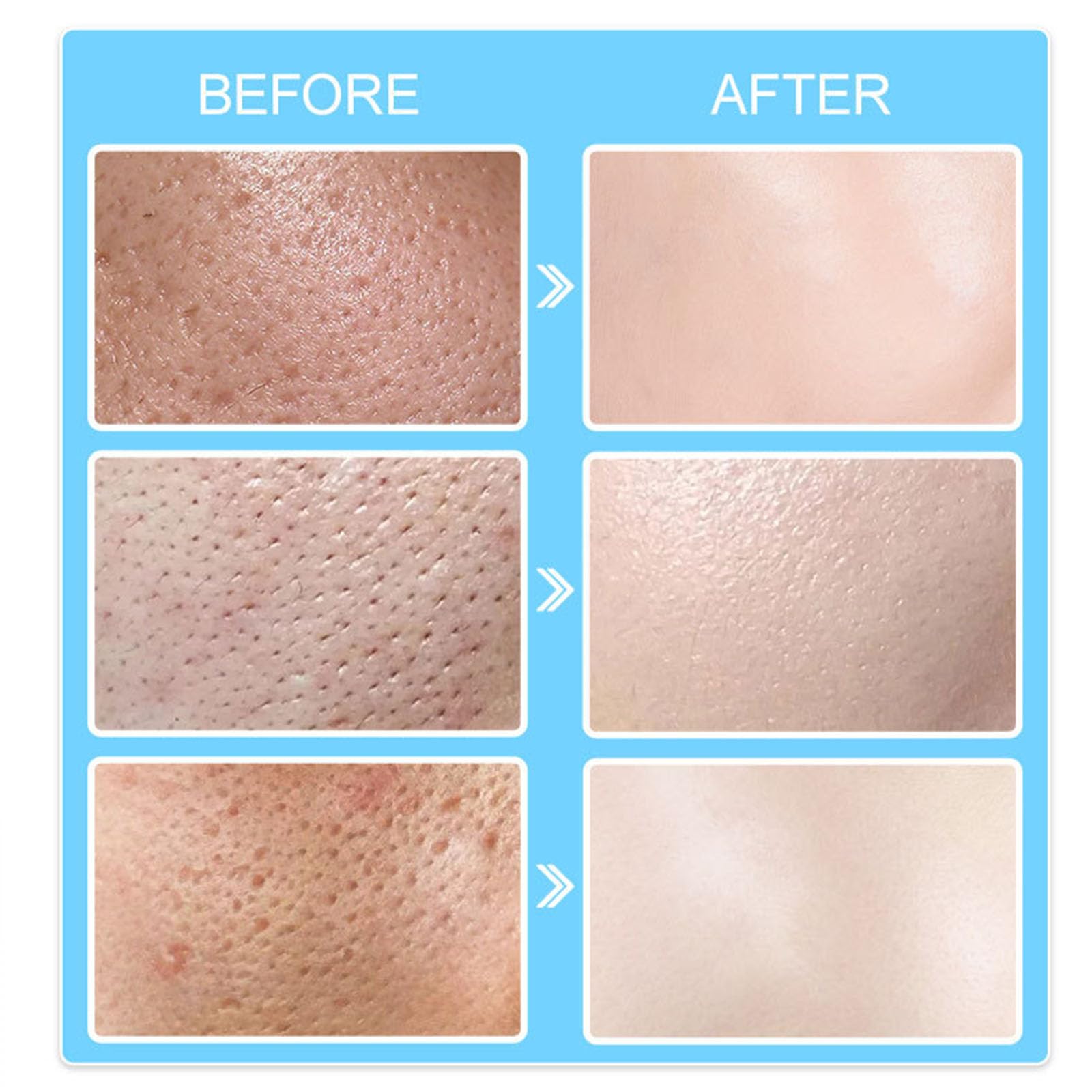 Grospe ingredient art highlighting collagen and hyaluronic acid for firmer skin