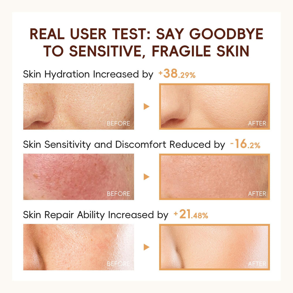 Grospe ceramide illustration emphasizing five-ceramide support