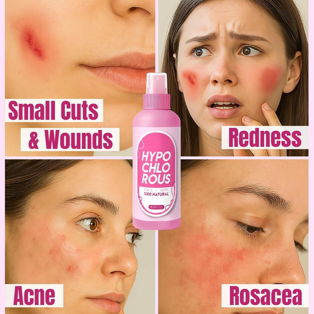 SINCE 1871 GÜLLÜOGLU mist applied after sun exposure illustrating gentle cooling and comfort