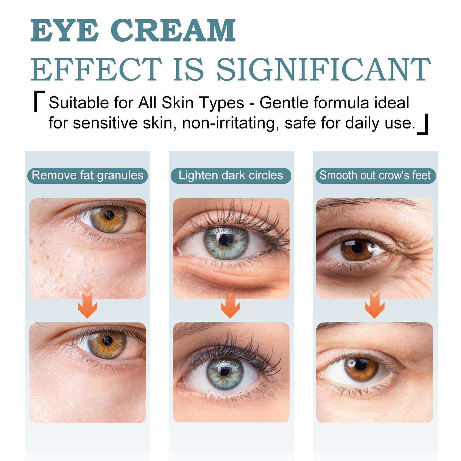 Before-and-after under-eye visual using Guwada showing reduced puffiness