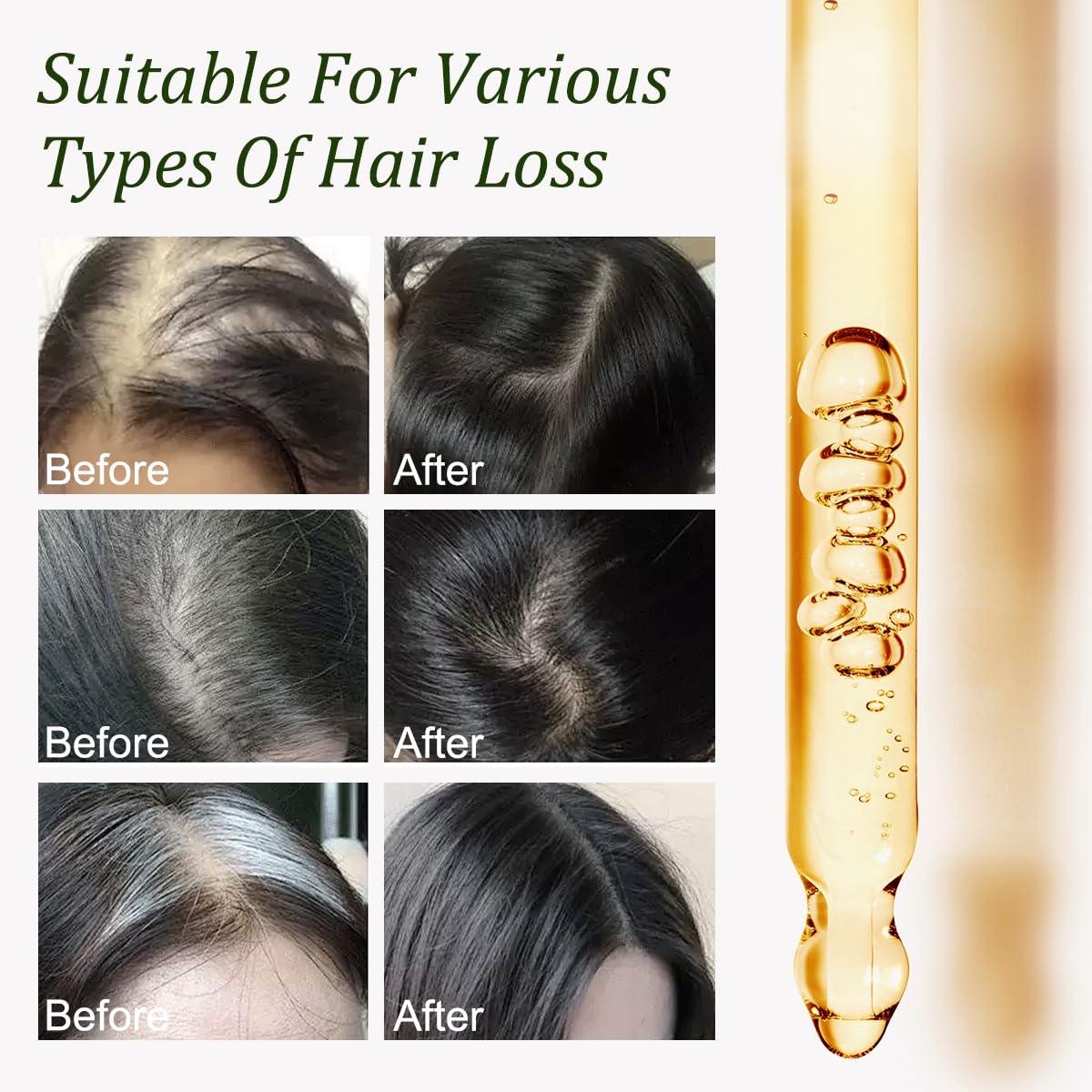 Applying Gypsophila Batana Oil during scalp massage to stimulate circulation and nourishment