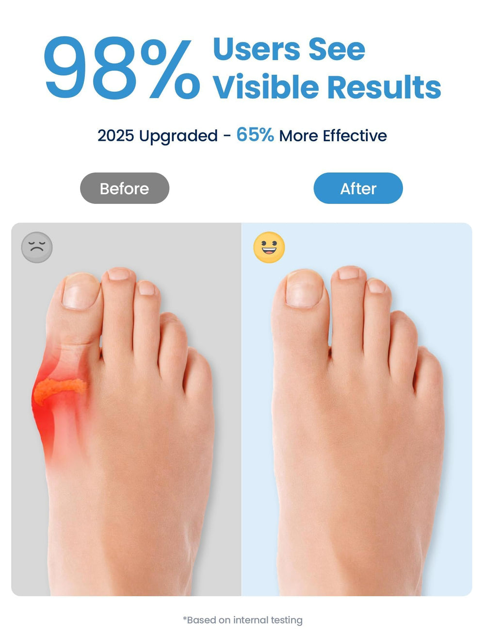 Habioer toe spacer inside casual shoe demonstrating discreet all-day wear comfort