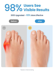 Habioer toe spacer inside casual shoe demonstrating discreet all-day wear comfort