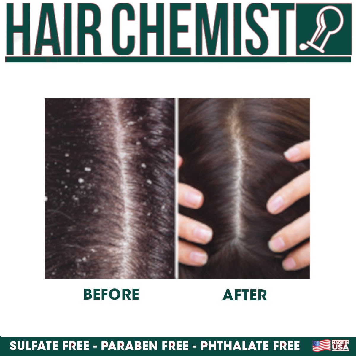 Hair Chemist applied to scalp with fingertip massage for cooling itch relief