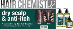 Hair Chemist before and after scalp image showing reduced flakes and comfort