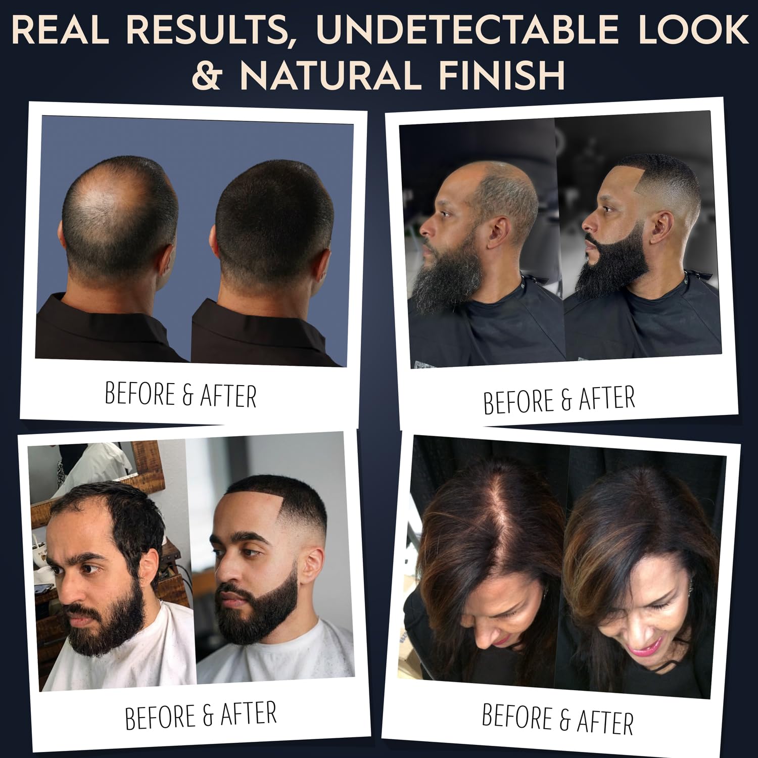 Using Hair Illusion on a patchy beard shows improved density benefit