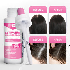 Hair Regen application on scalp demonstrating precise placement benefit