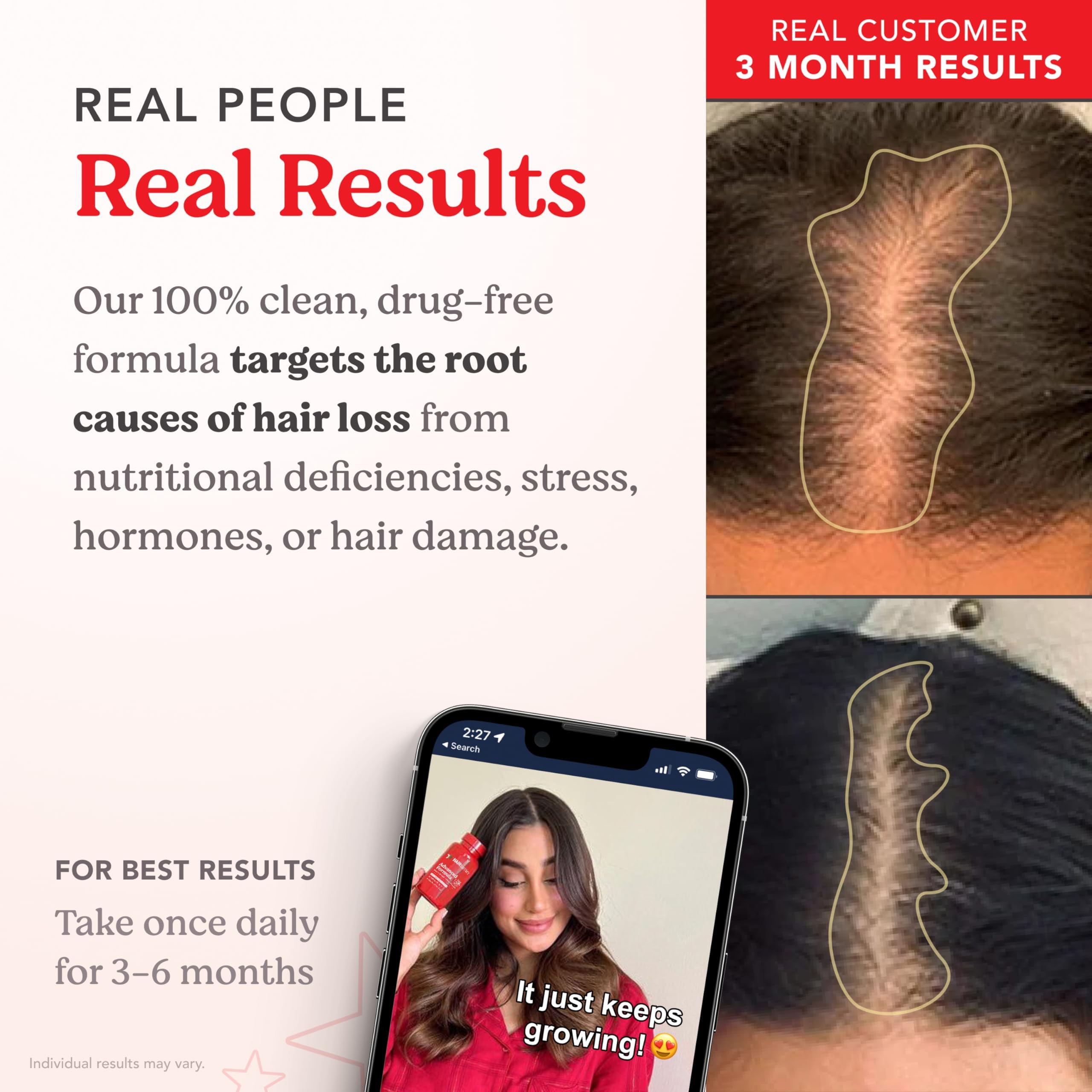 HAIRtamin capsule in hand demonstrates single daily dose convenience